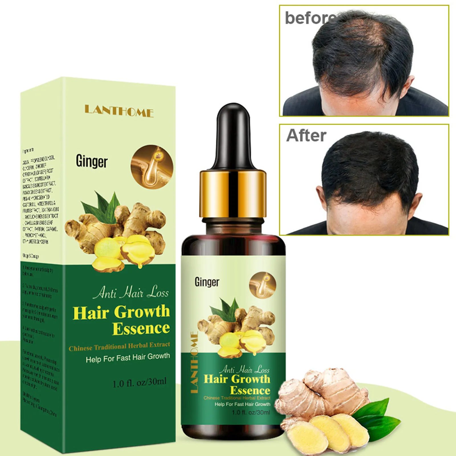 

Имбирные продукты для роста волос Эфирные масла для роста волос для утолщения и предотвращения выпадения волос имбирное масло для волос