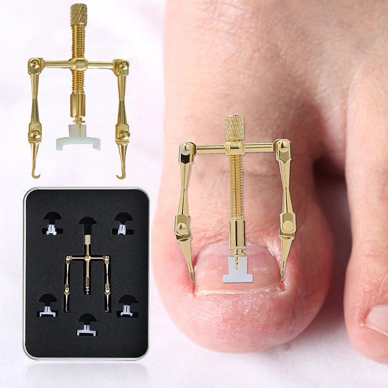 

YOHAPPY Ingrown Toe Nail Correction Tool Fixer Recover Toe Paronychia Nail Brace Tools Ingrown Toenails Pedicure Tool