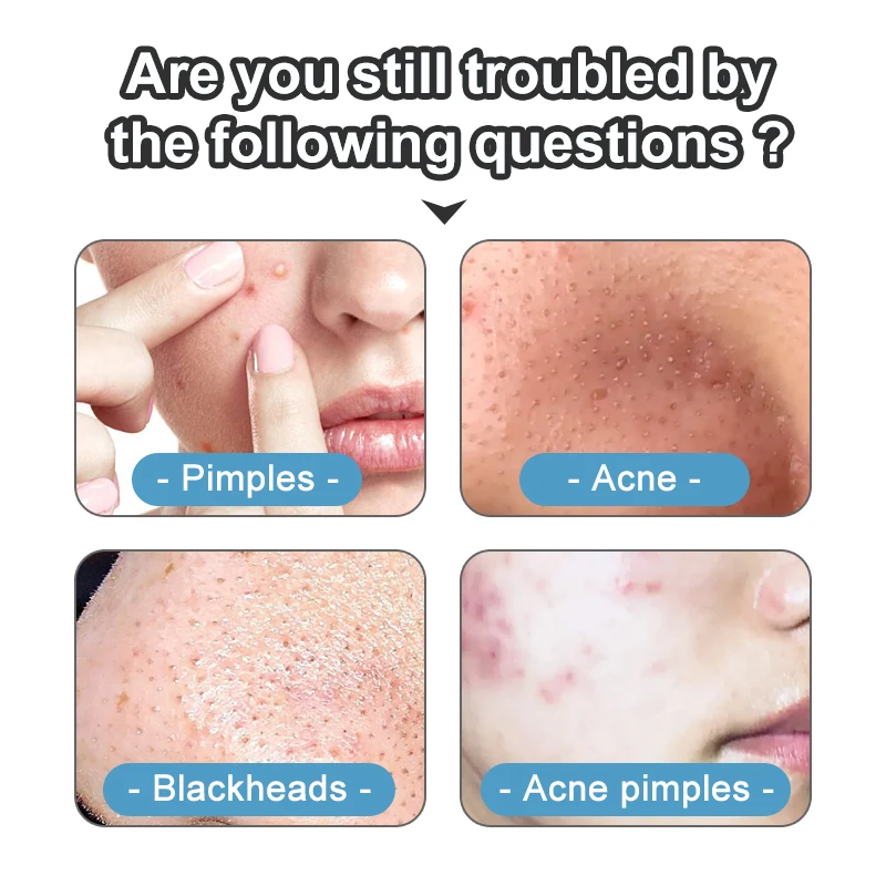 Blackhead Acne Remover Tool Stainless Steel Needles Comedone Black Spot Pimple Treatment For Face Skin Care Facial Pore Cleaner |