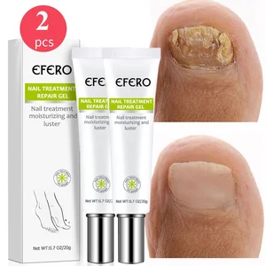 Anti-Fungal Nail Gel Fungal Nails Treatment Serum Hand Foot Cream Repair Toenail Remove Infection On