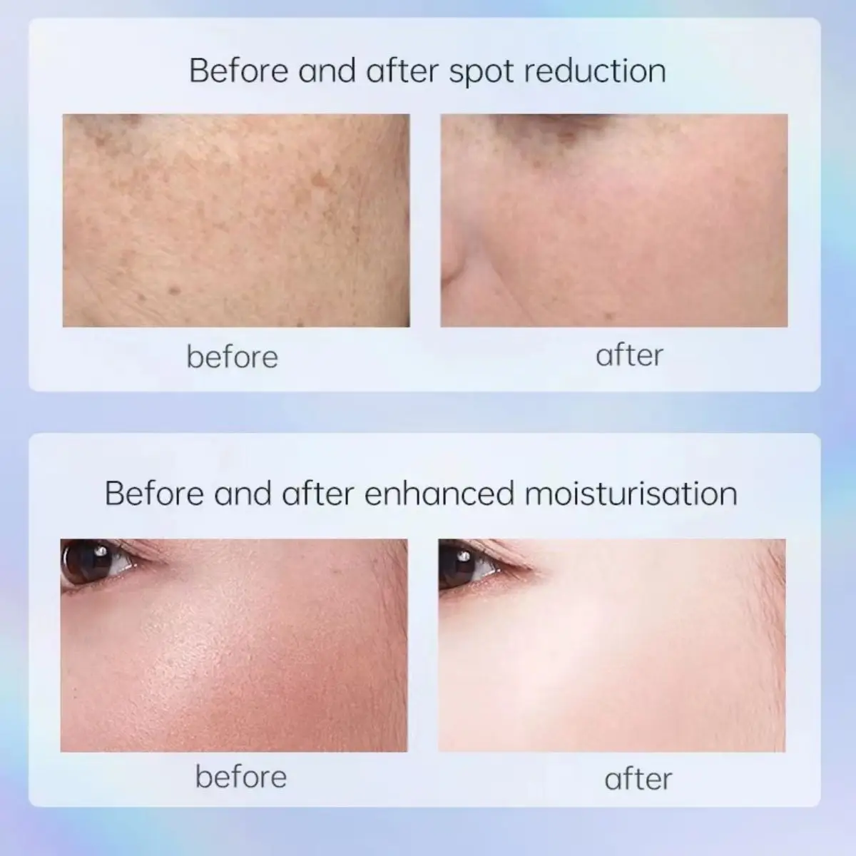 Суперлюминесцентная маска для ухода за кожей лица мягкая и не вызывает