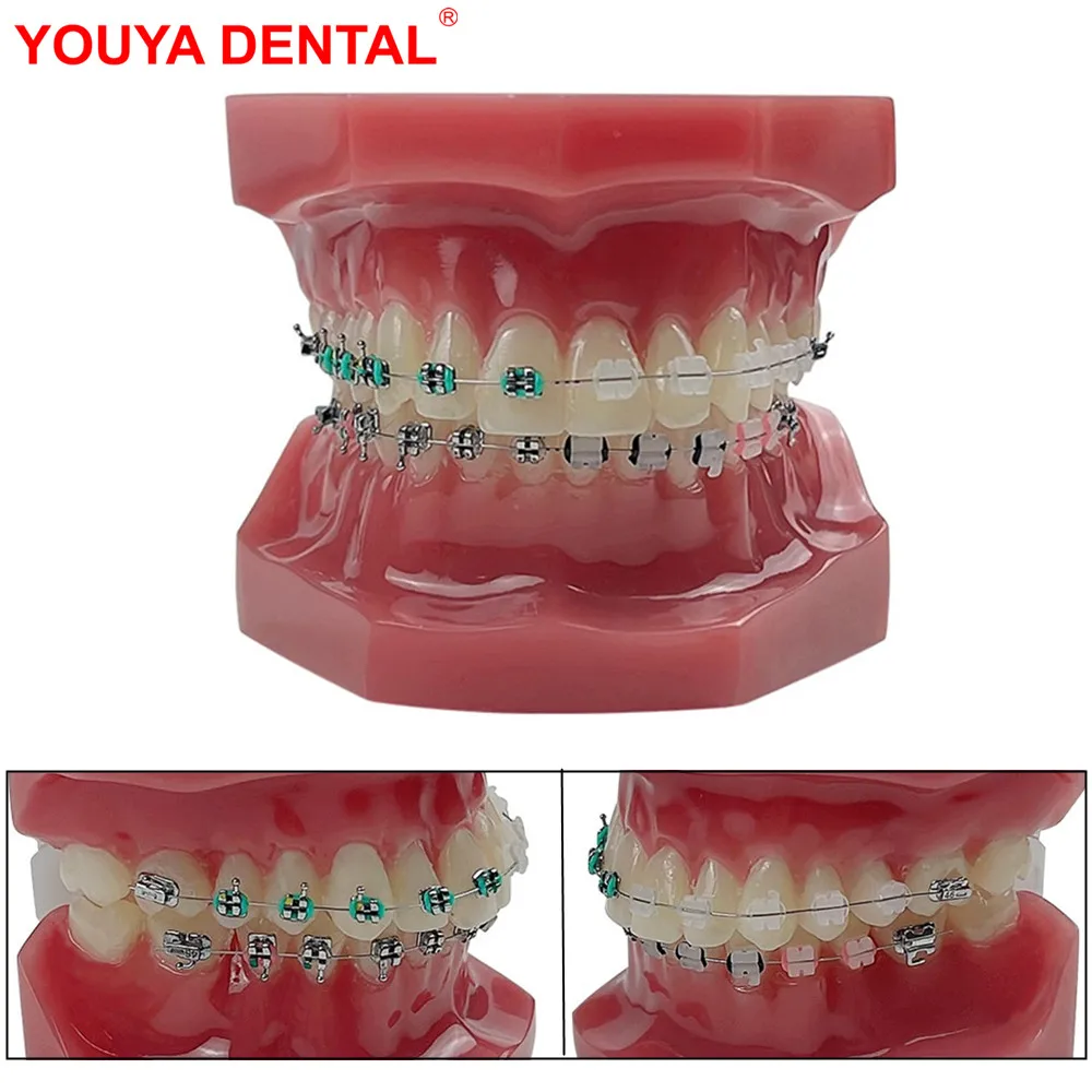 Обычная ортодонтическая стоматологическая обучающая модель с