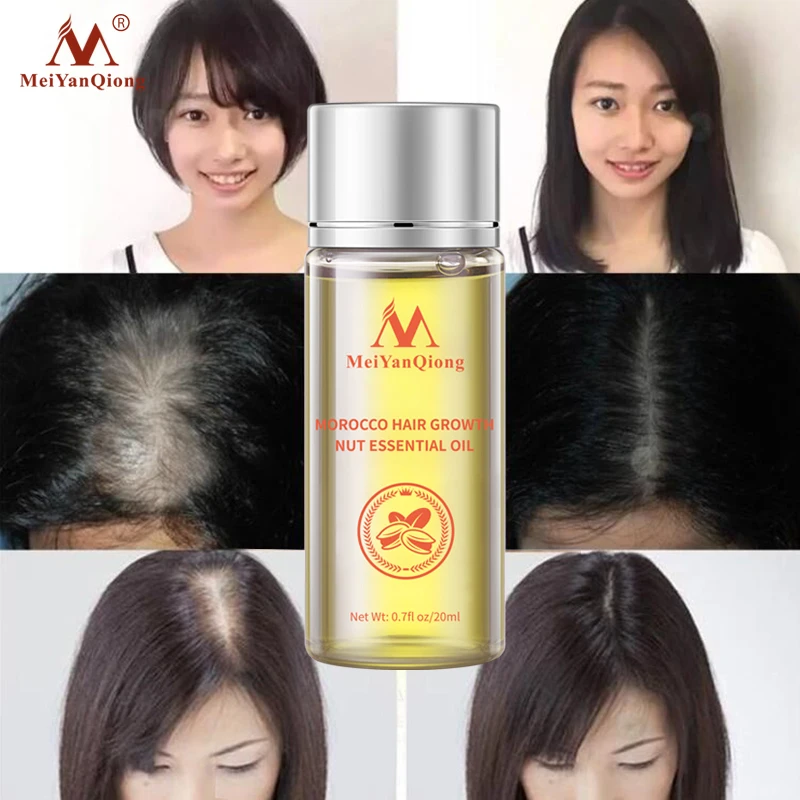 20ML Morocco Hair Growth Nut Essential Oil Dryness Relief Drops Frizz Smooth Anti-hair Loss Treatment Nourish Scalp Massage |