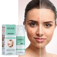 effective acne removal cream treatment acne scar shrink pores oil control whitening moisturize face acne skin care