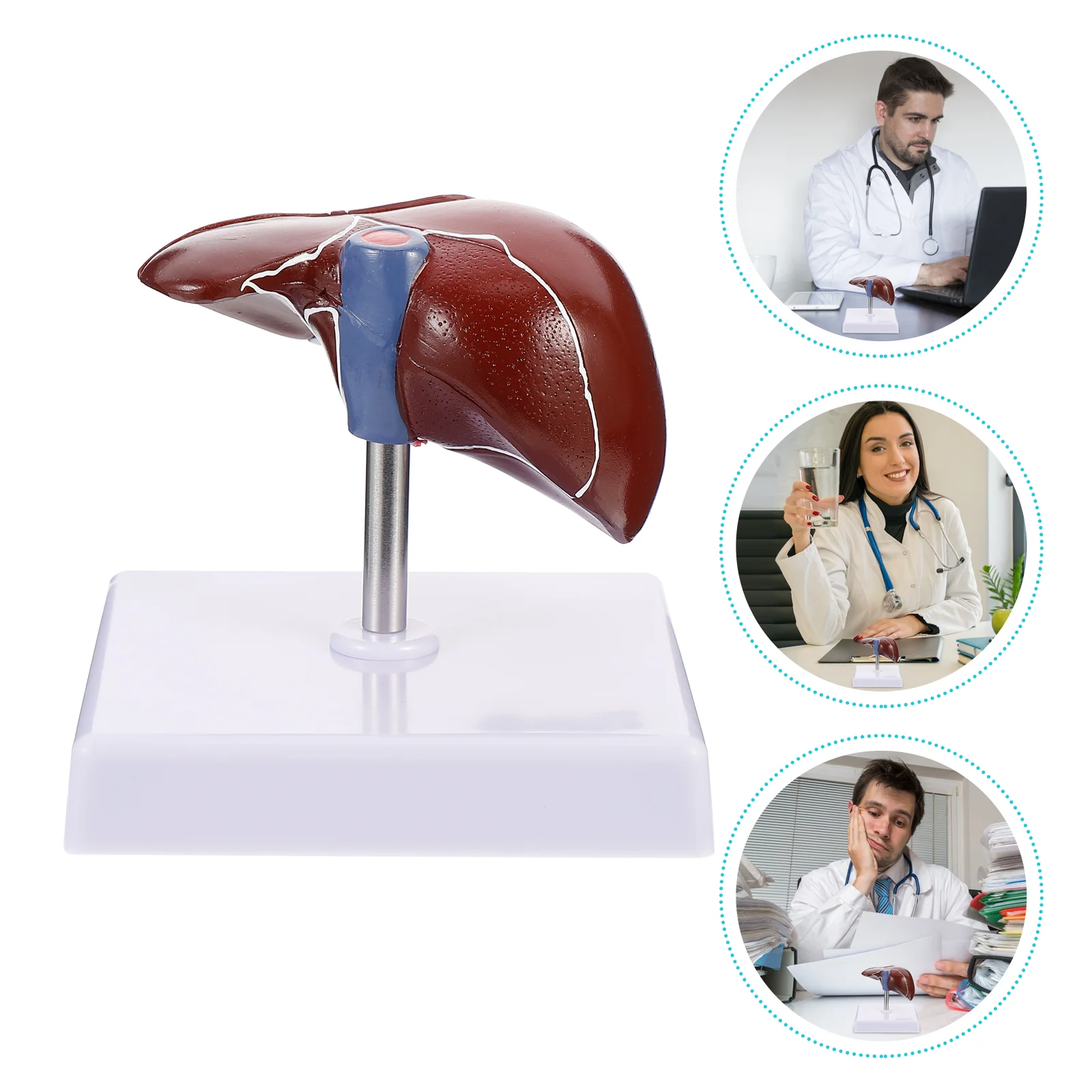 

1pc Medical Anatomical Liver Model Human Liver Pathological Model with Base