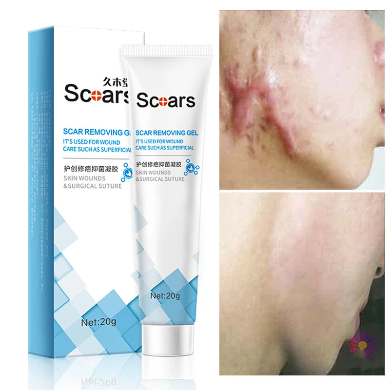 Herbal Scar Removal Cream Gel Stretch Marks Repair Acne Spots Burn Surgical Old New Scars Remover Treatment Whitening Skin Care