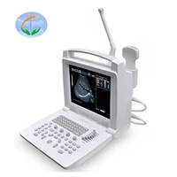 popular home used black and white full digital ultrasound scanner ultrasonic imaging system