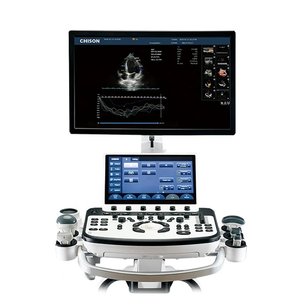 Высококлассная ультразвуковая система