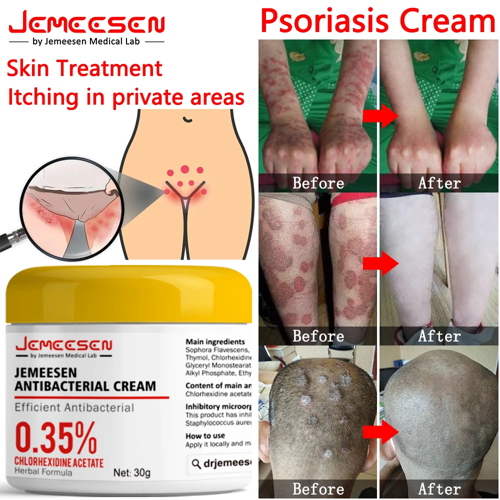 Рисунок 2 - Jemeese крем от псориаза мазь для экземы