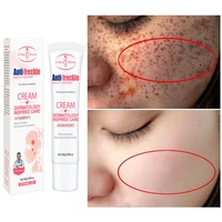 effective whitening freckle cream remove dark spots melanin freckles improve dull skin niacinamide brightening anti aging care