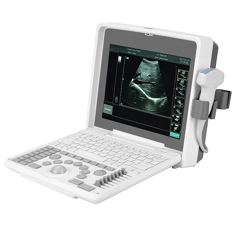 

SINOHERO Portable 12.1 Inch Led Notebook Black And White Ultrasound Scanning For Hospital Use
