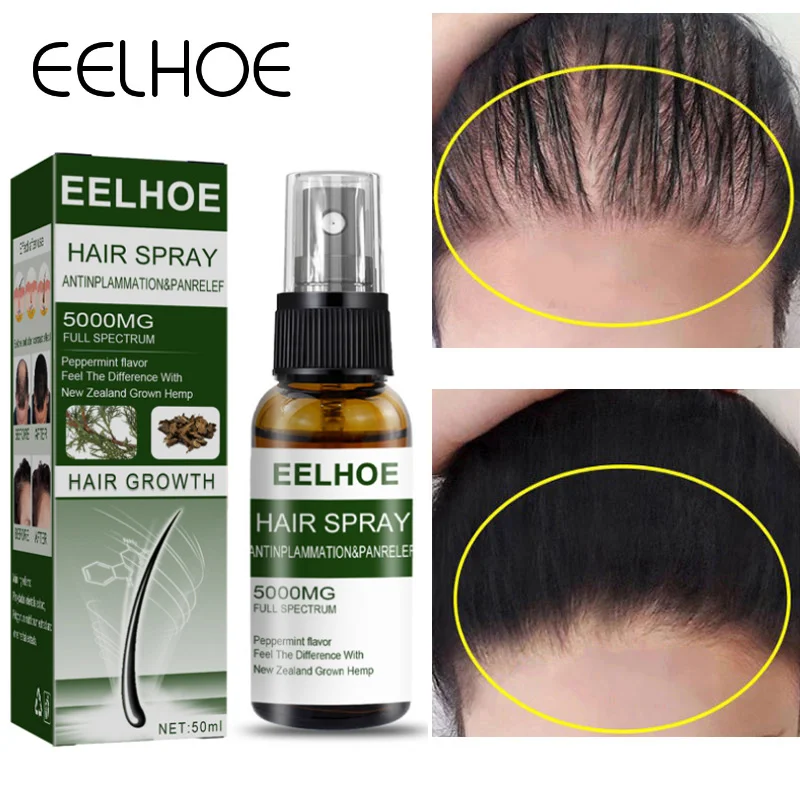 

50ml Fast Hair Growth Products Anti Hair Loss Spray Essence Nourish Scalp Repair Frizzy Damaged Men Beard Growth Essential Oils