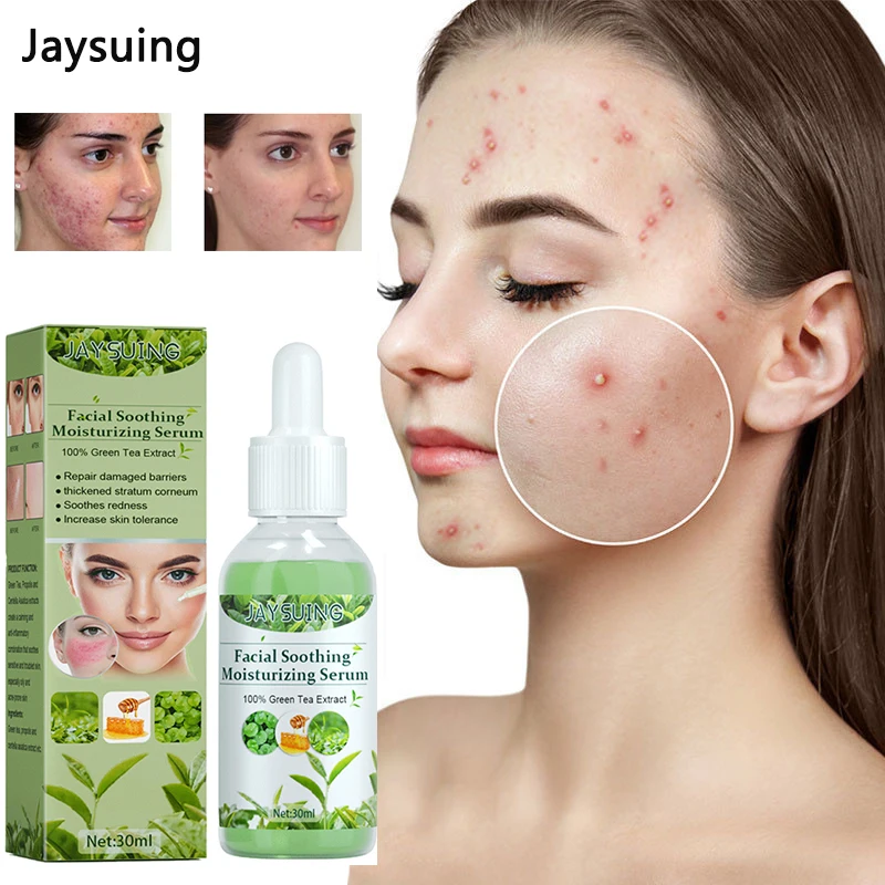 

Green Tea Acne Treatment Face Serum Oil Control Shrink Pores Essence Fade Acne Marks Repairing Soothing Moisturizing Skin Care