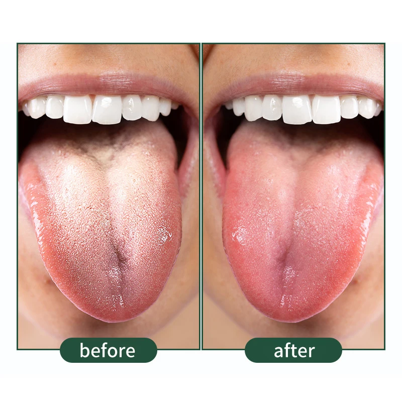 Многоразовый скребок для свежего дыхания языка моющийся инструмент чистки