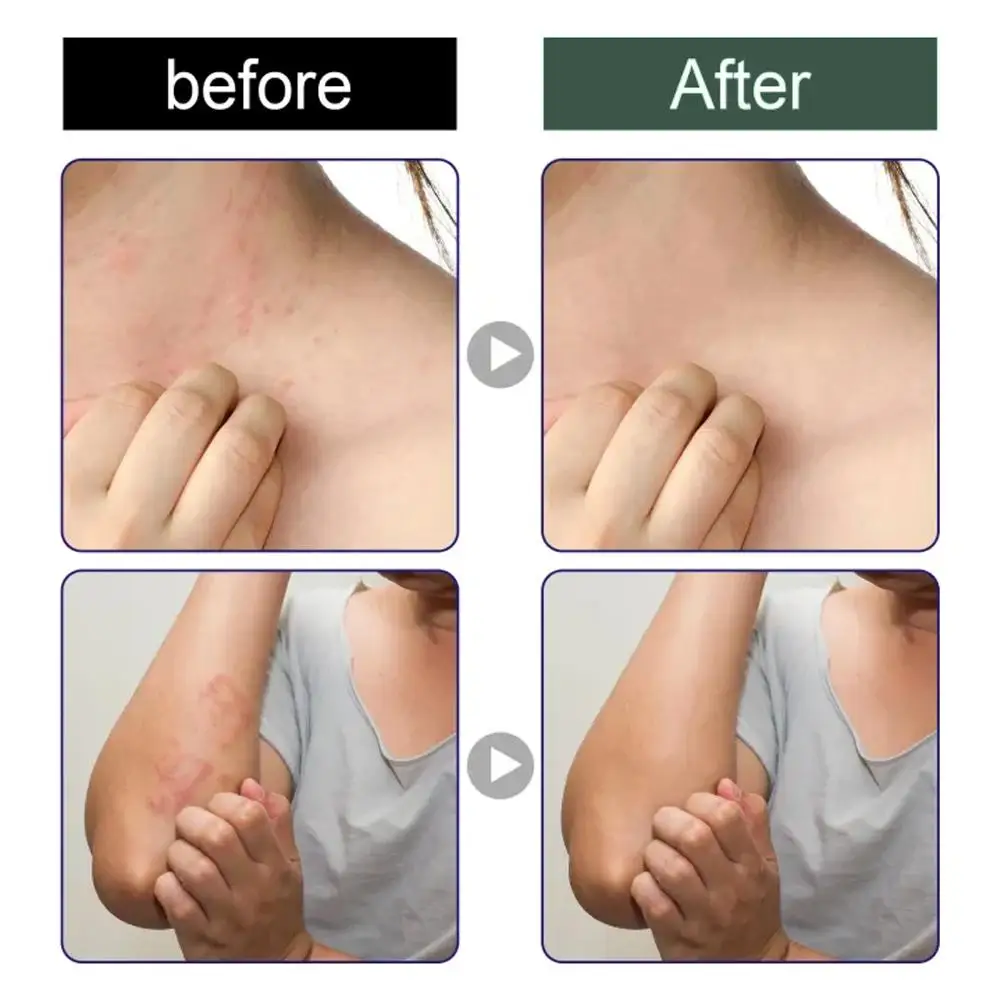 Рисунок 3 - Крем против зуда экологичный восстанавливающий