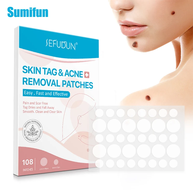 

108 шт./коробка, пластырь для удаления бородавок и бородавок