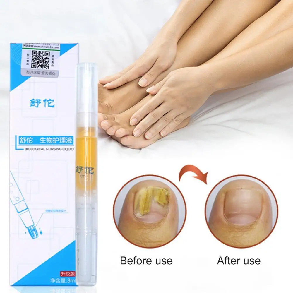 

4 шт., жидкость для восстановления ногтей