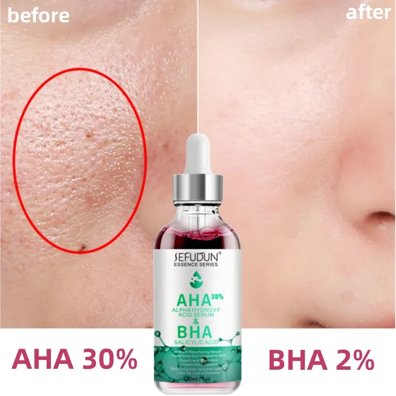 

AHA+BHA Fruit Acid Serum for Face Salicylic Acid, Aloe Vera Acne Treatment Scars,Dark Spots,Wrinkles,Fine Lines Facial Skin Care