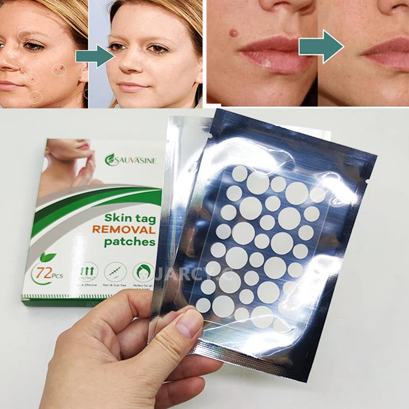 

72pcs/sheet Skin Tag Remover Tool Warts Remover Patch Wart Treatment Herbal Extract Face Corn Plaster Acne Warts Sticker