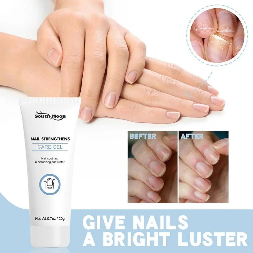 

Гель для лечения Ногтей, восстанавливающая эссенция для ухода за ногами, онихомикоз, антиинфекционный восстанавливающий гель для ногтей, уход за ногами, грибок пароничи G8v9