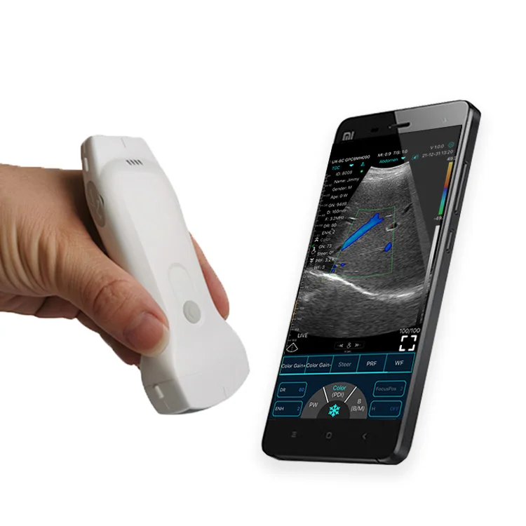 

New style konted handheld 3 in 1 color portable doppler medical wireless ultrasound probe for abdomen/vascular examination