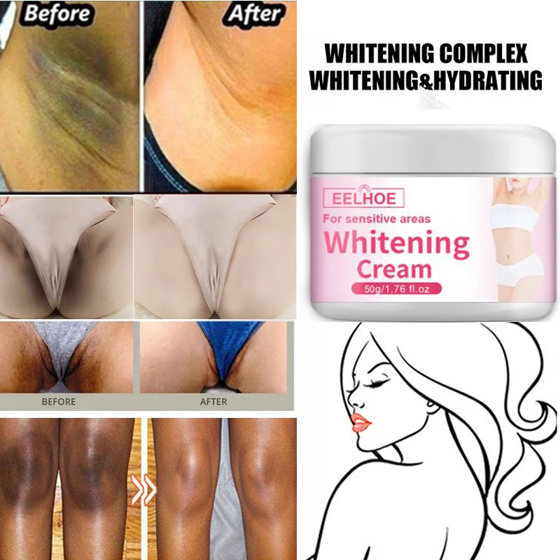 

Whitening Body Cream Remove Armpit Legs Knees Bikini Private Dark Skin Moisturizer Brighten Tender Nicotinamide Intimate Care