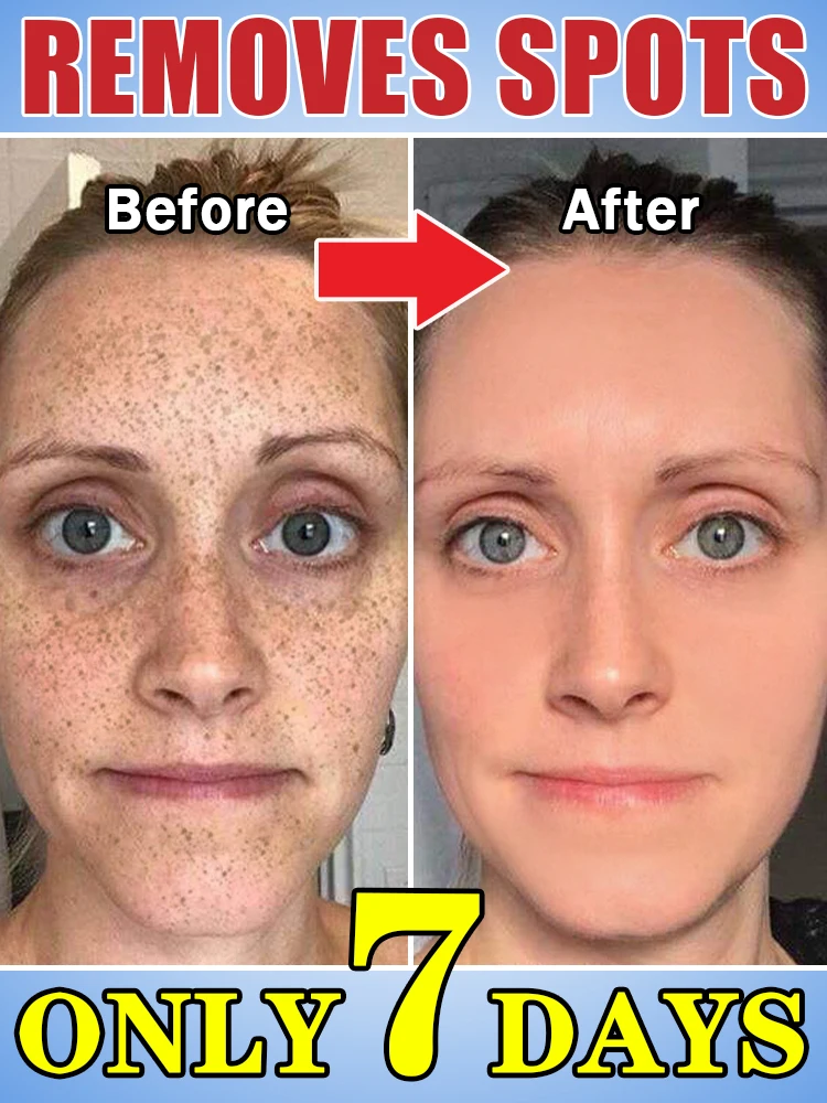 ʸ ᵒᵉ ᵉ ᵒ ˢ ᵃᵃᵃᵃᵃᵃᵃᵃ