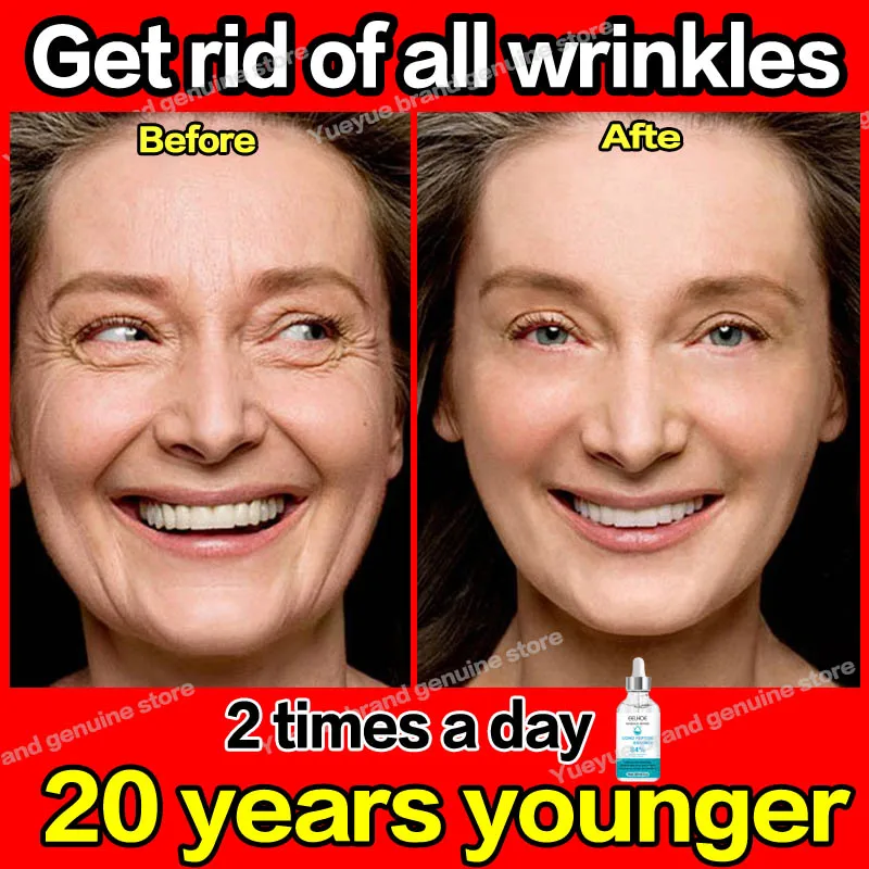 Anti-aging wrinkle-removing facial serum to eliminate facial wrinkles, fine lines around the eyes, crow's feet and neck wrinkles
