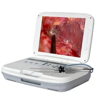 video endoscope medical ent hd endoscopy camera