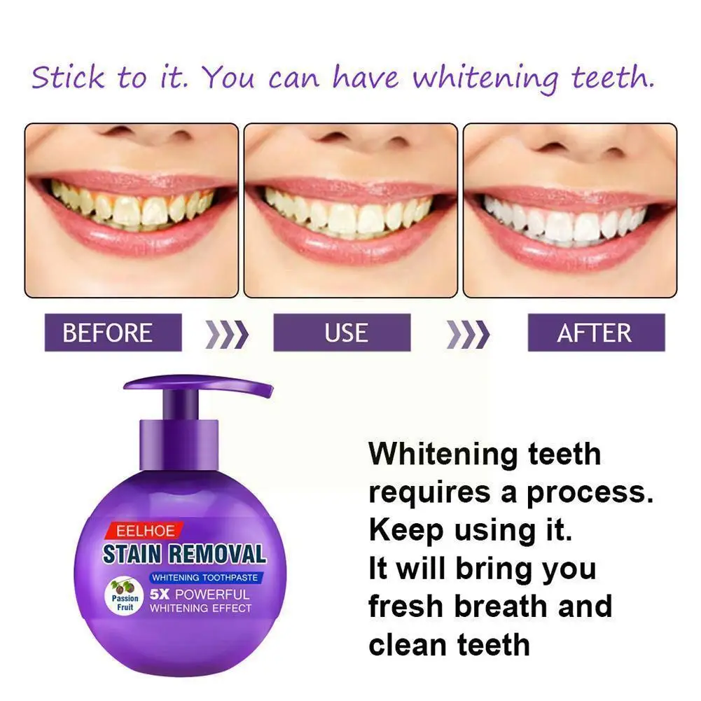 

250g Whitening And Stain Removing Baking Soda Toothpaste, Fruit Gum Fights Passion Bleeding Blueberry, Q6s9