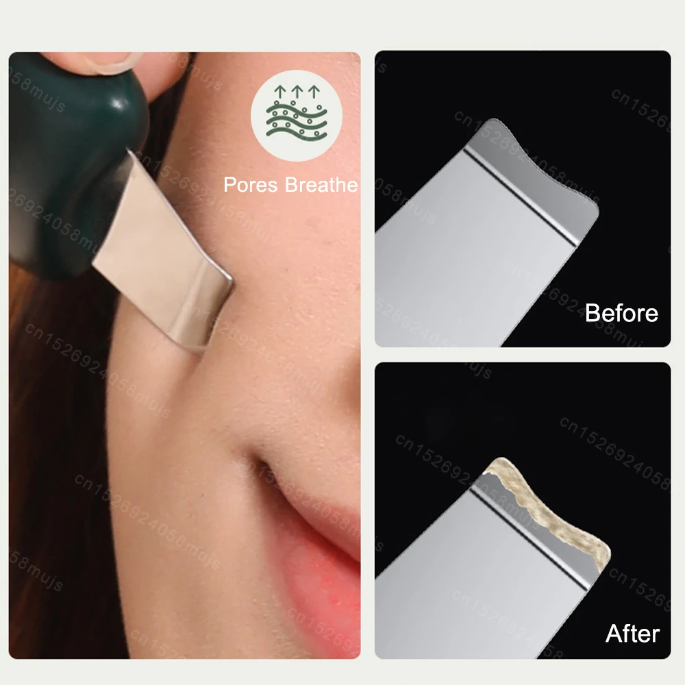 Средство для удаления черных точек средство очистки устройство сужения пор