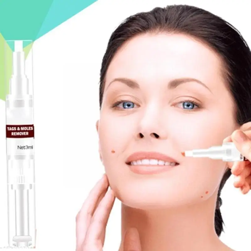 

1 шт., жидкая ручка для удаления бородавок и бородавок, 3 мл