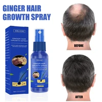 30ml ginger hair growth spray serum treatment hair loss products fast grow black prevent hair dry frizzy damaged thinning care