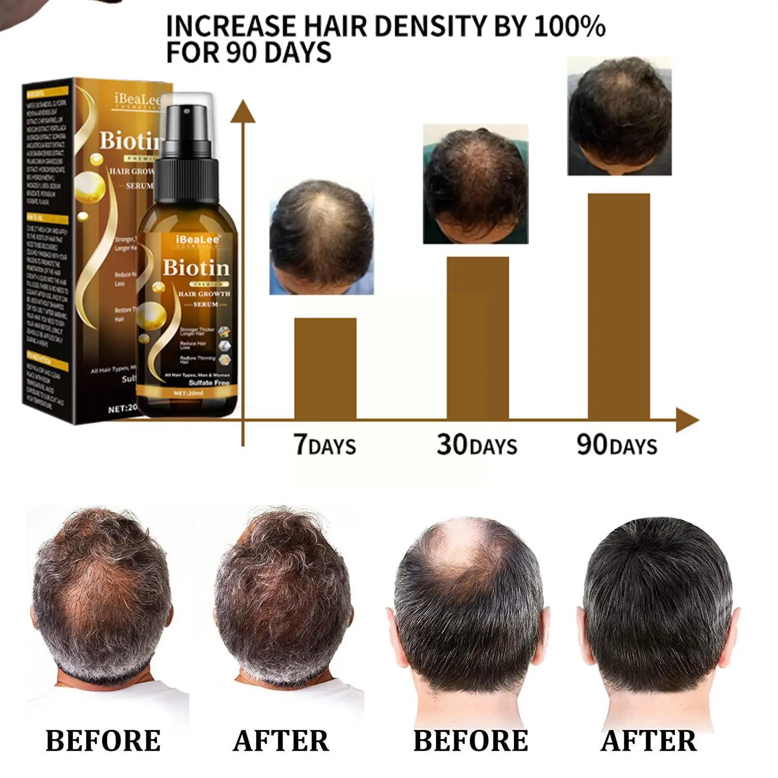 

Продукты для роста волос Biotin быстрорастущий Уход За Волосами Эфирные масла против выпадения волос спрей лечение кожи головы для мужчин женщин волос
