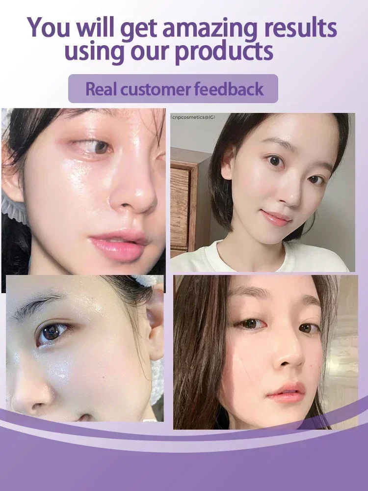 Сыворотка для минимизации пор кислота сужение удаление больших черных точек