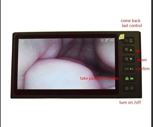 Видео уретероскоп с процессором