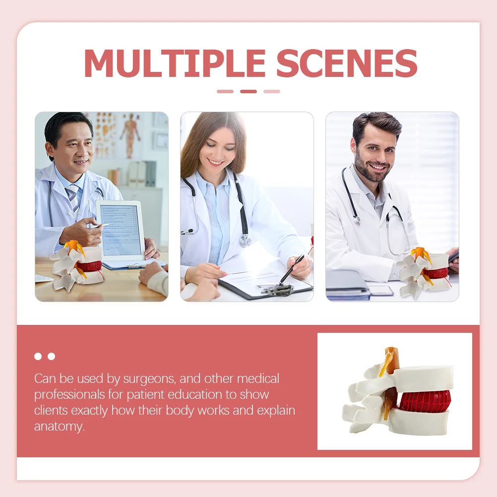 Анатомическая модель для хиропрактора межпозвонковых дисков модели поясничных