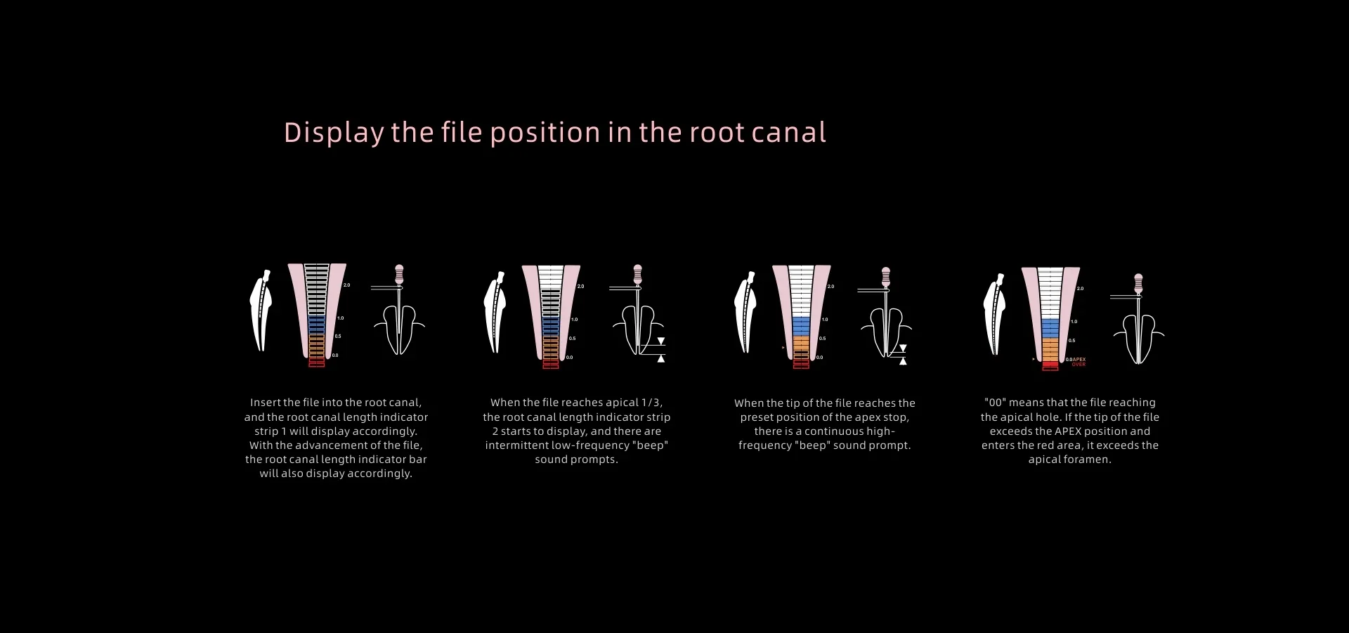 Оригинальный стоматологический локатор вершины Woodpex V многофункциональная