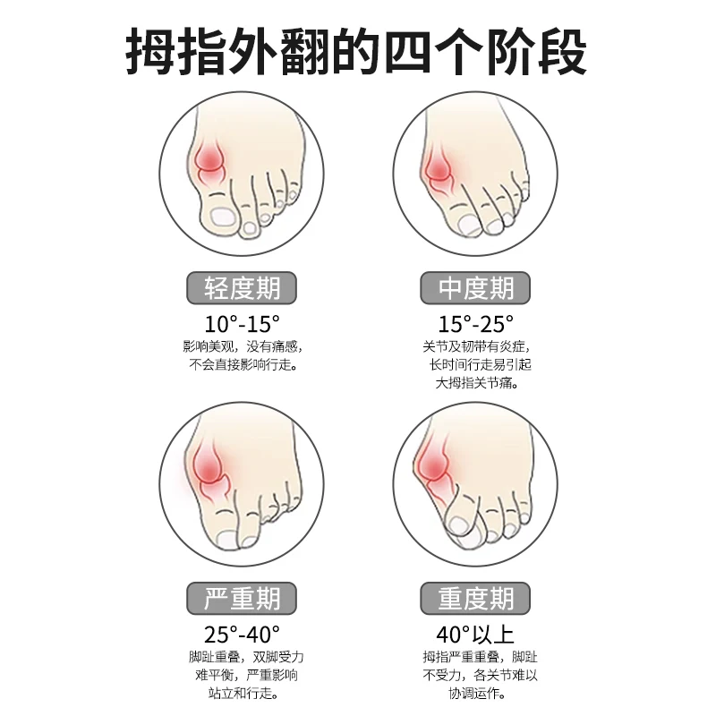 Ортопедическая обувь для мужчин и женщин при вальгусной деформации