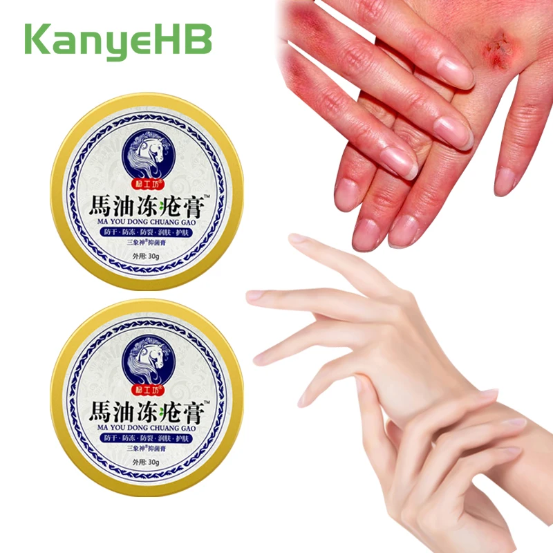 

2pcs Anti Crack Foot Cream Moisturizing Itching Repair Hands Feet Winter Dryness Anti-chapped Traditional Chinese Horse Oil A919