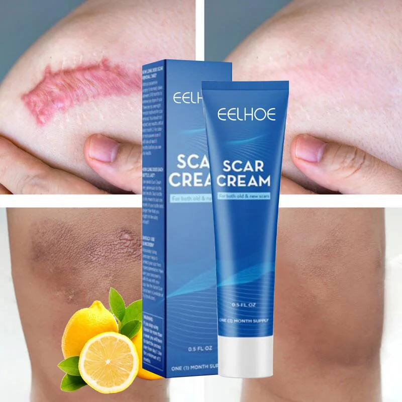 

Acne Scar Remove Cream Skin Care Treatment Stretch Mark Burn Scar Gel Whiten Nourish Repair Body Pigmentation Corrector