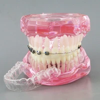 dental orthodontic model with metal self ligating ceramic braces retainer demonstration study teeth model m3012