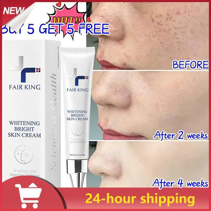 

20g Freckles Cream Dark Spot Corrector Skin Whitening Fade Cream Skin Care Lightening Blemish Removal Spots Anti-Age Face Cream