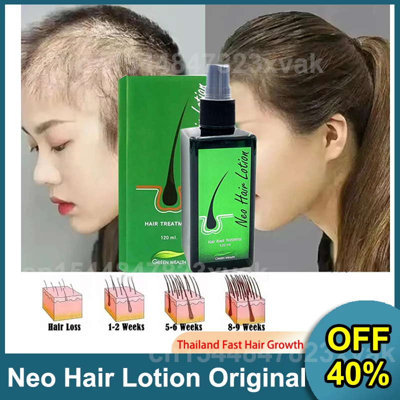 

neo hair lotion hair care oil hair grow Serum essential hair loss treatment product hair growth for men orginal Natural thailand