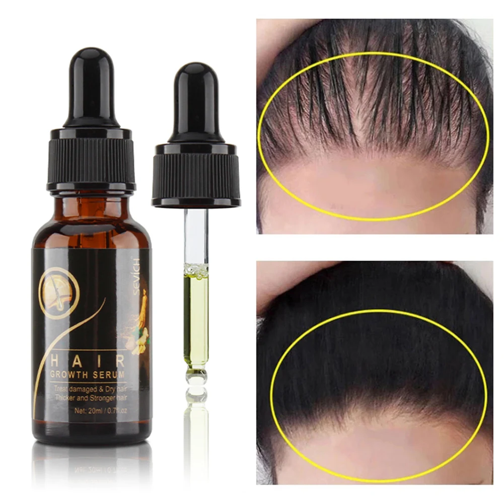 

Hair Growth Essence Serum Damaged & Dry Hair Repairing Nourishing Essence Prevent Hair Loss Hair Growing Treatment Serum 20ml