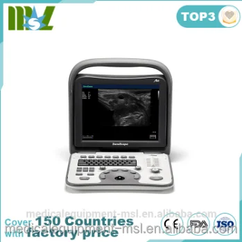 Запчасти для ультразвукового сканера Sonoscape A5