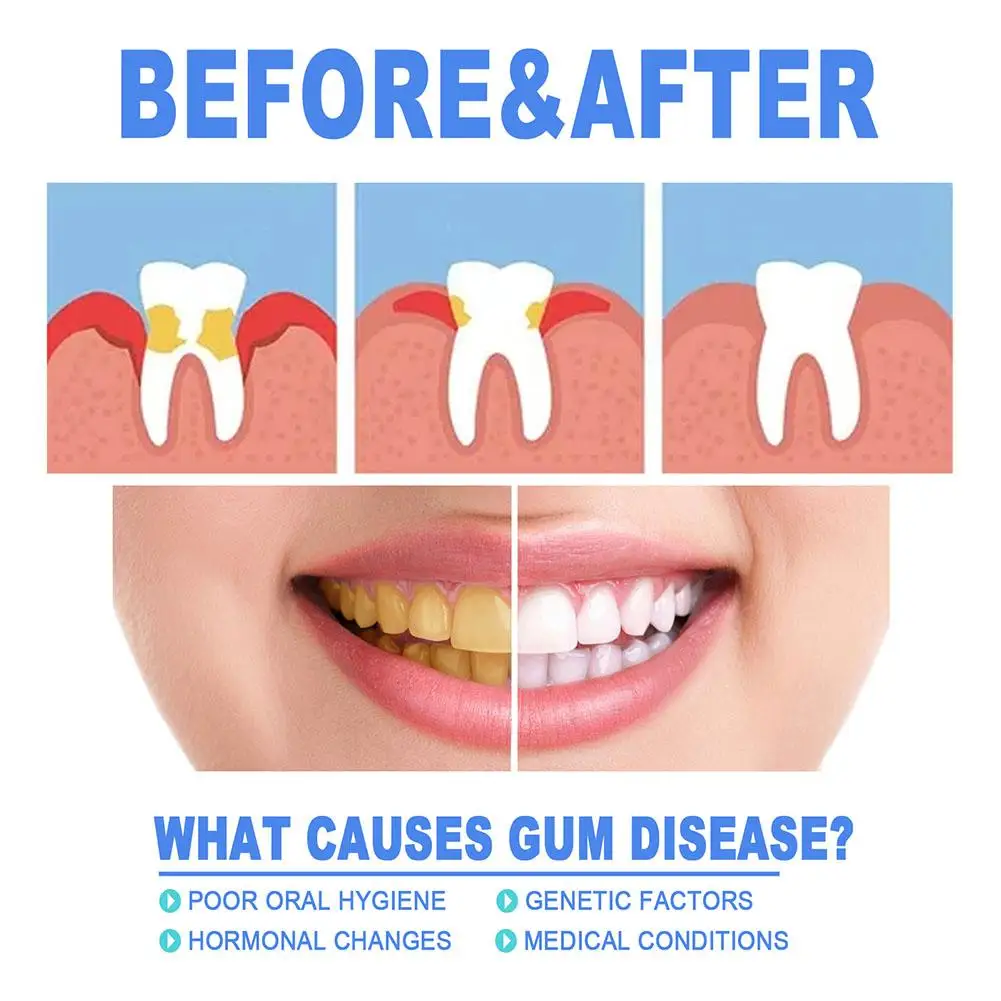 Рисунок 5 - гель для восстановления десен