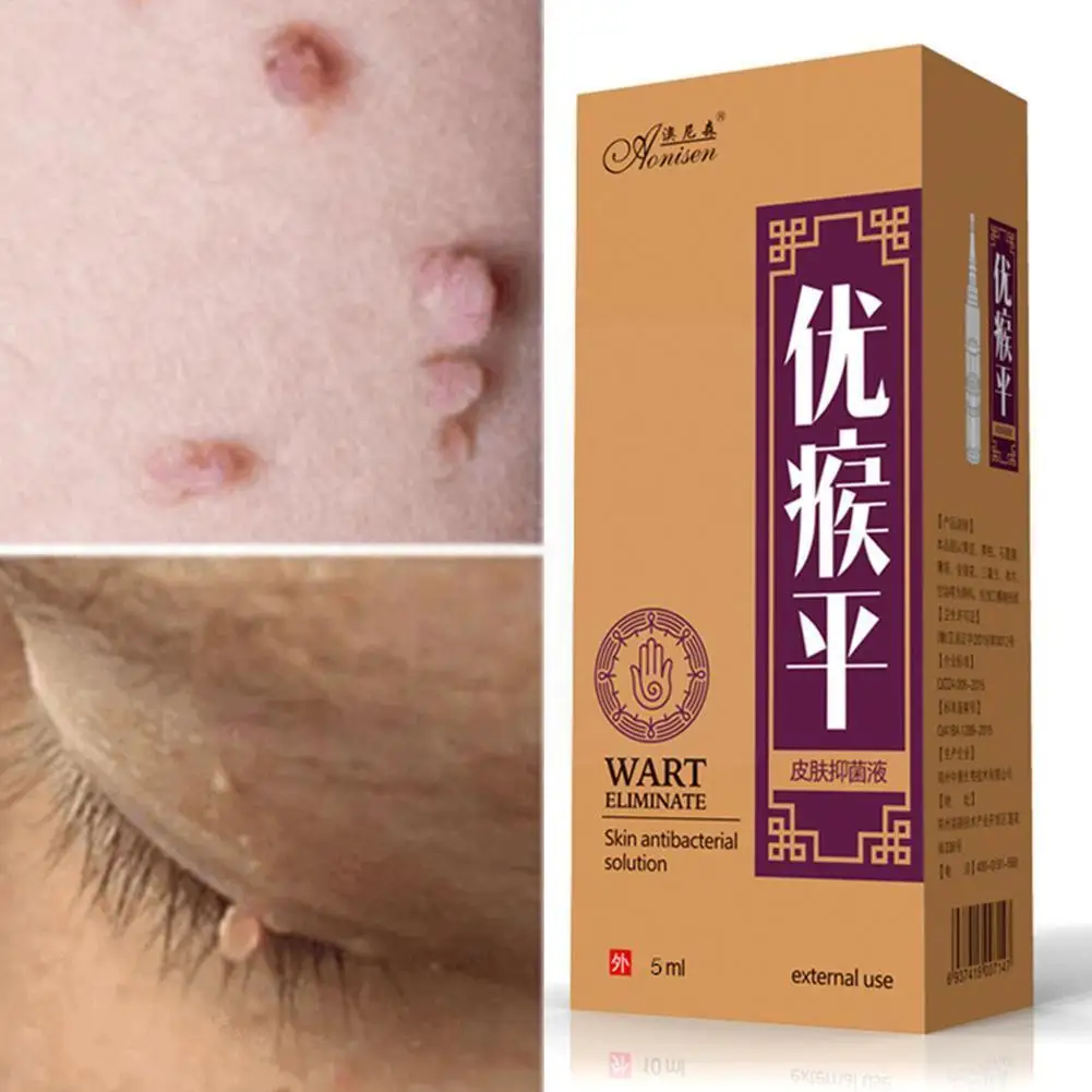 

Skin Tag Remover Medical Against Moles Removal Genital Wart Acne Skin Corn Anti Foot Treatment Care Liquid Spot N5a7