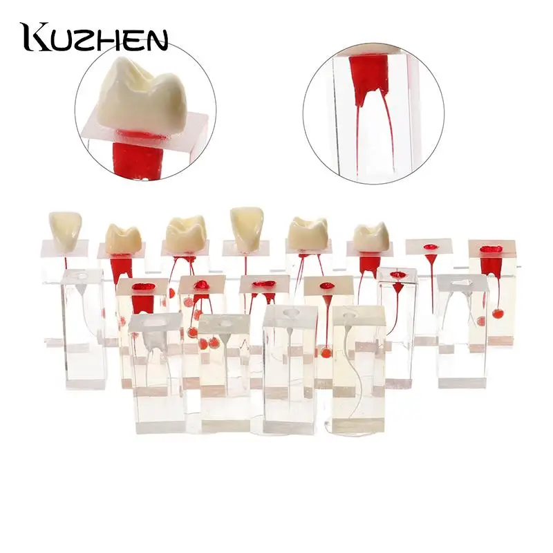 

Dental Endodontic Root Canal Model For Student Studying Training Dentistry Education Teaching Demo Teeth Model Resin Red White