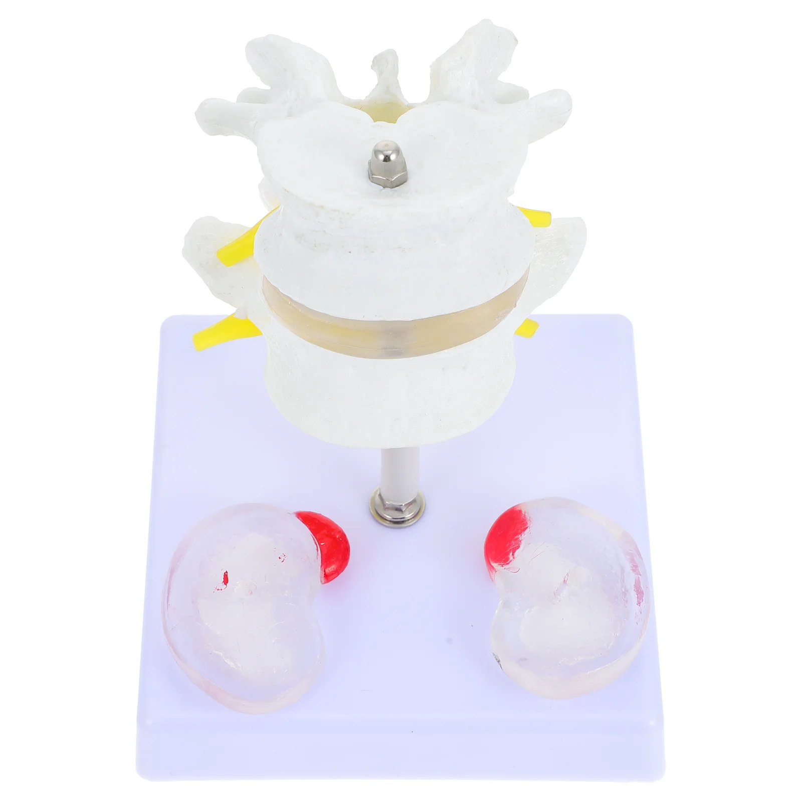 

1 Set Human Spine Model Lumbar Disc Model Lumbar Vertebrae Model for School